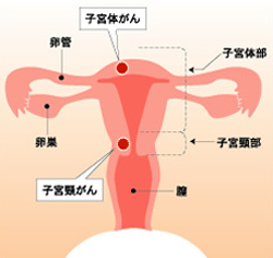 がんを早期発見・早期治療するために